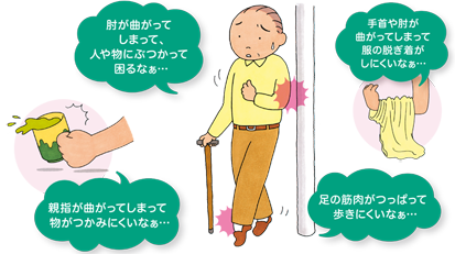 ボツリヌス療法 装具外来 麻生リハビリ総合病院 ボツリヌス療法 装具外来 麻生リハビリ総合病院